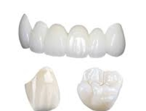 Răng Toàn sứ Ziconia