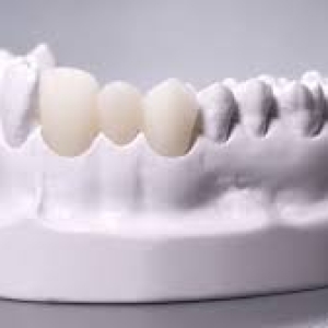 rang-toan-su-cercon-duc