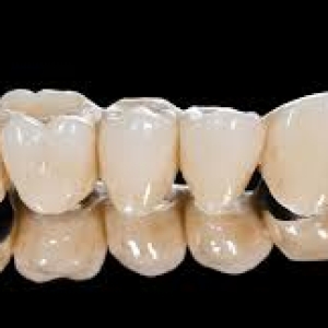 rang-su-kim-loai-caramco