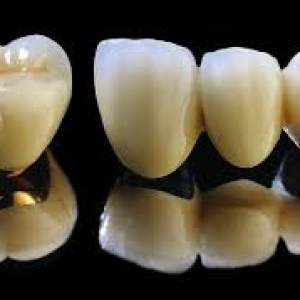 rang-su-titan-vita-duc