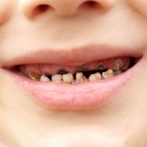 lorem-ipsum-has-been-the-in-1-1-1-1