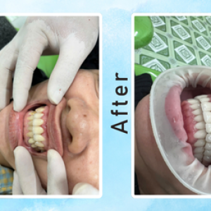 khach-hang-tay-trang-rang