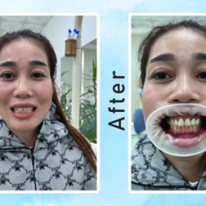 khach-hang-lam-rang-su