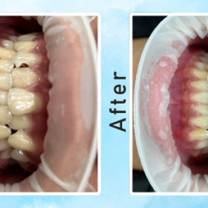 khach-hang-trong-rang-su-tham-my