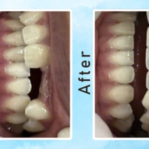 khach-hang-trong-rang-su-cao-cap