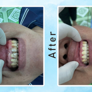 khach-hang-boc-rang-su-tham-my