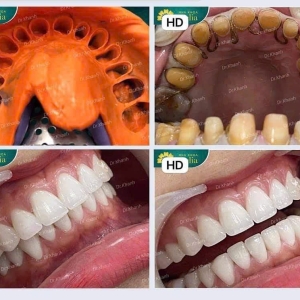 lorem-ipsum-has-been-the-in-1-1-1